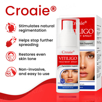 [Official Store]:Croaie® Vitiligo Treatment Spray- Natural Skin Tone Restoration
