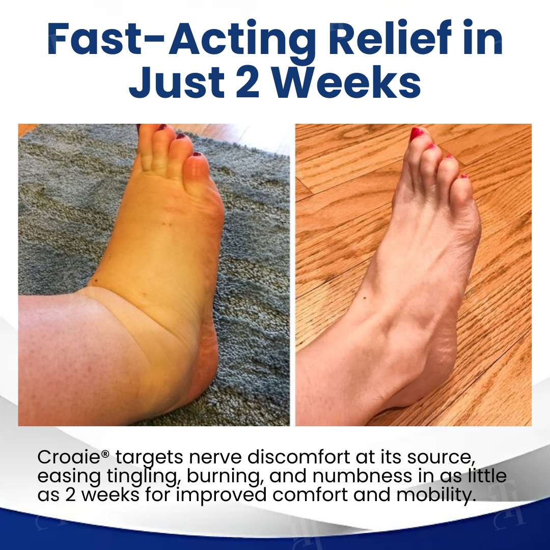 Croaie® NerveRestore Neuropathy Spray -Targeted Relief That Actually Gets There - In Just 30 Seconds