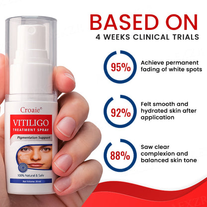 [Official Store]:Croaie® Vitiligo Treatment Spray- Natural Skin Tone Restoration