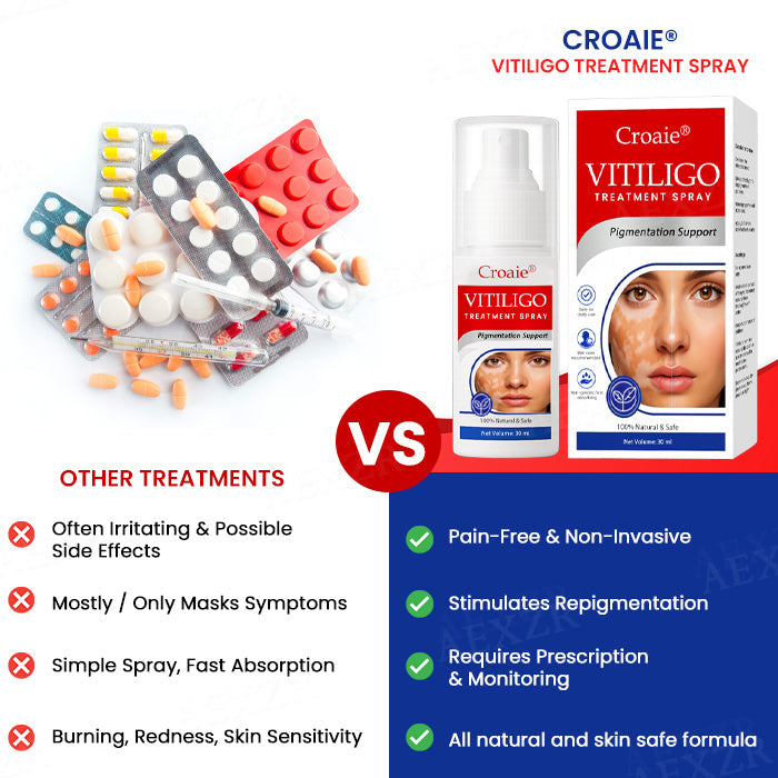 [Official Store]:Croaie® Vitiligo Treatment Spray- Natural Skin Tone Restoration